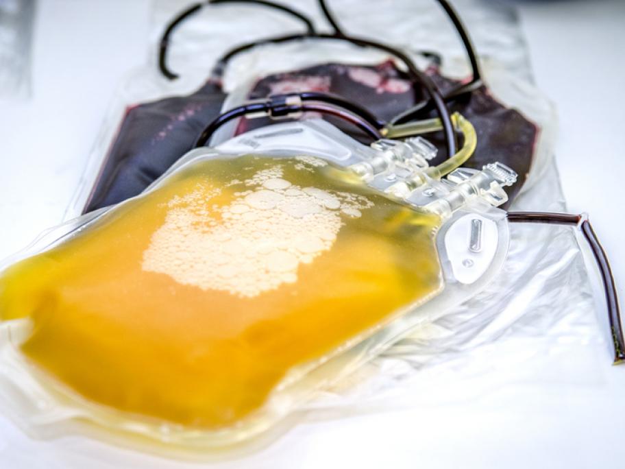 plasma