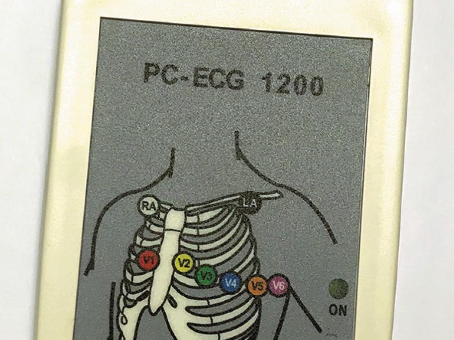 ECG