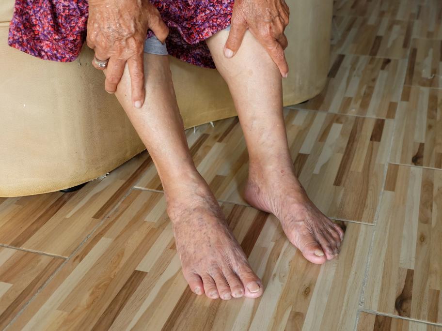 restless legs