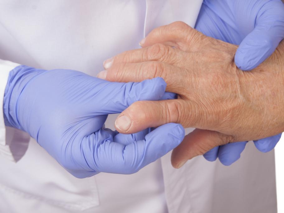 Doctor examining hadn of woman with RA