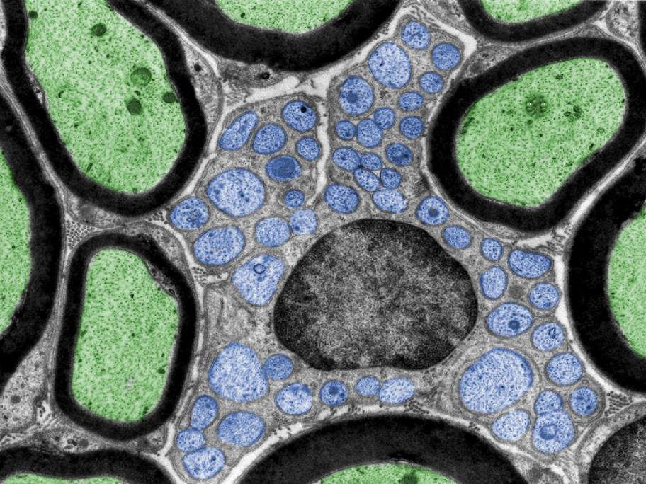 Schwann cell