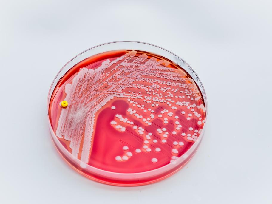 Staphylococcus aureus
