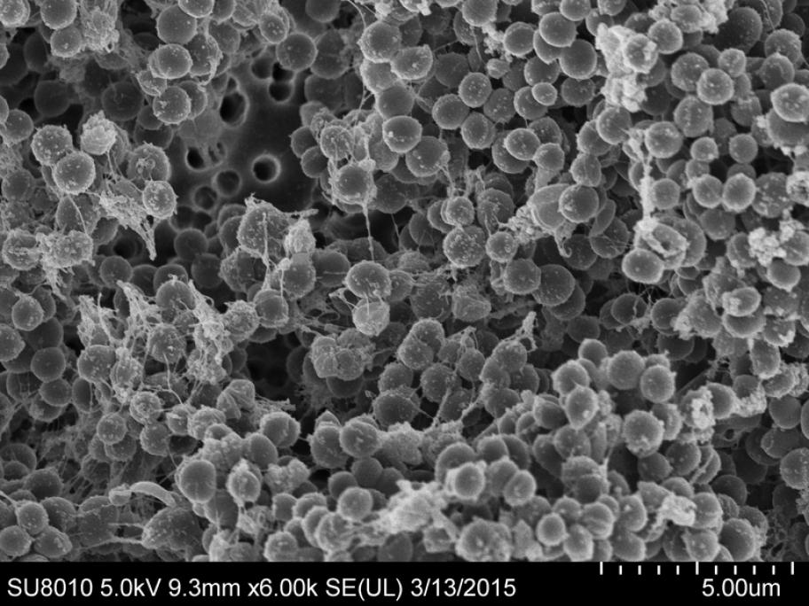 Electron micrograph of stapylococci