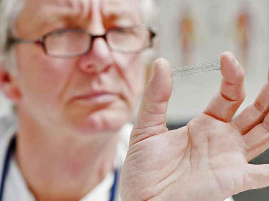stent