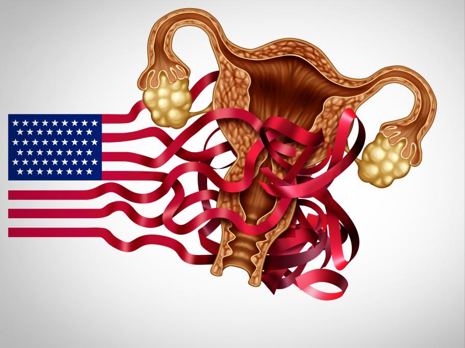 laws abortion