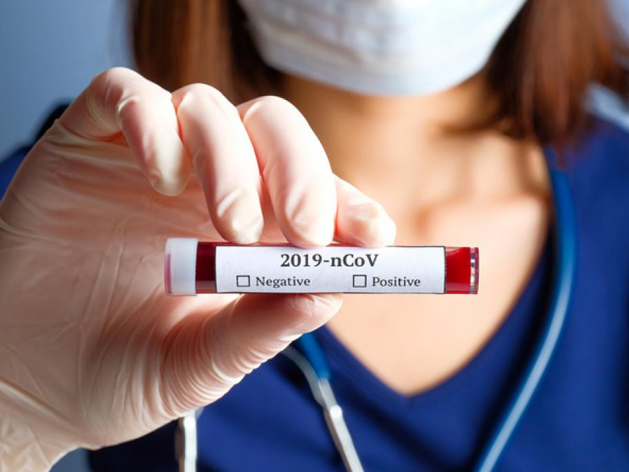 Virus