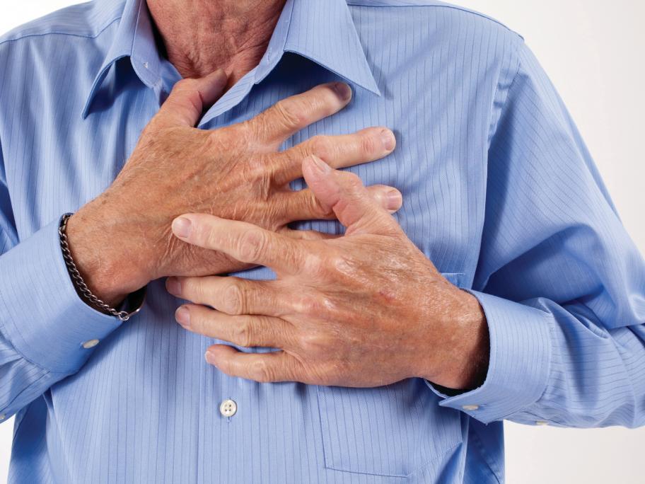 Cardiac events