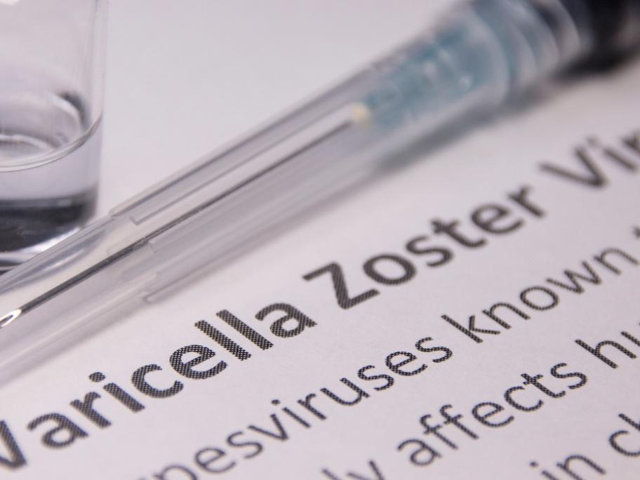Zoster