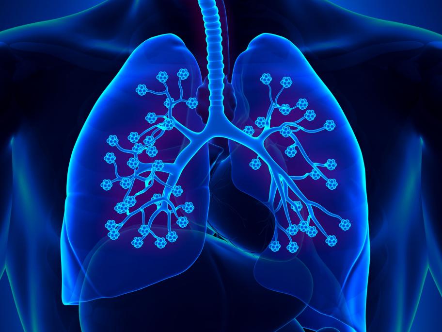 COPD