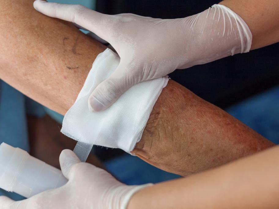Dressing wound