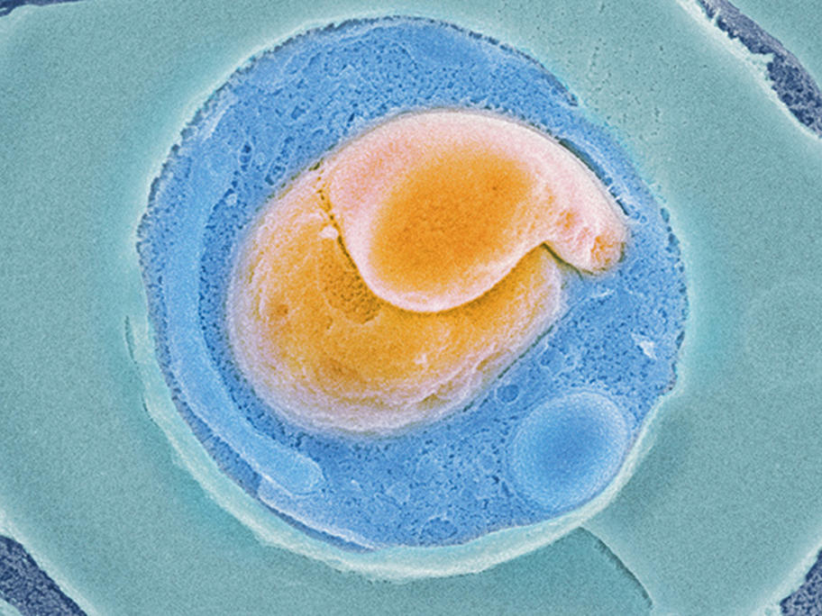 drug-resistent malaria