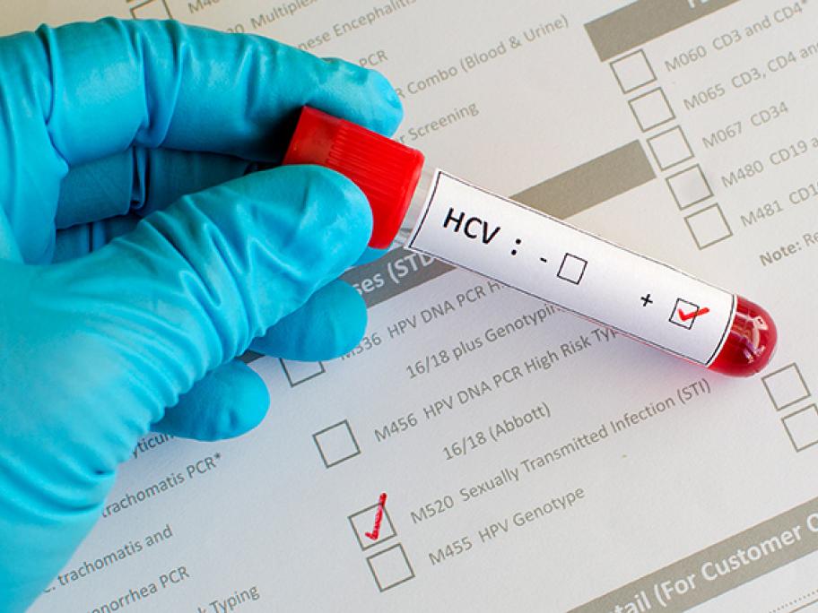 HCV test