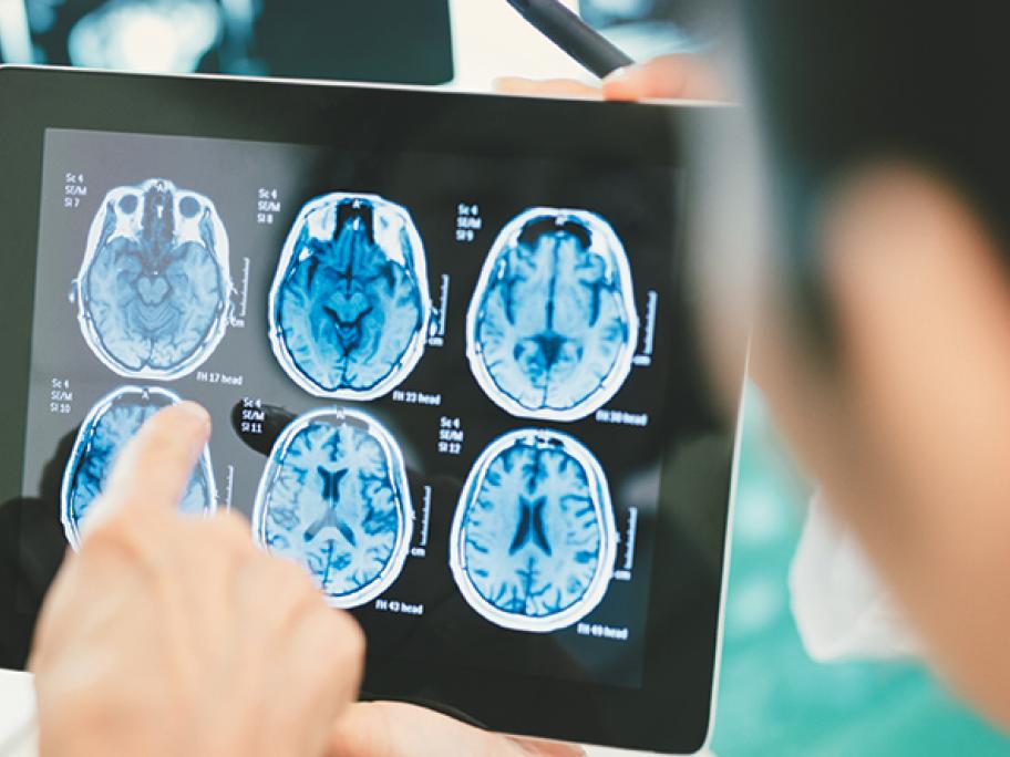 Brain MRI scan