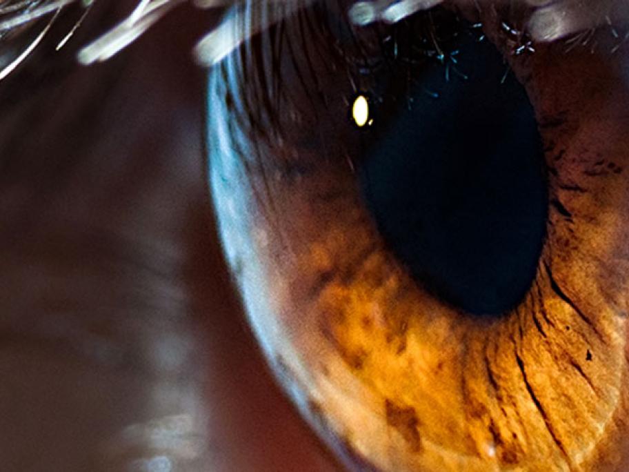 eye