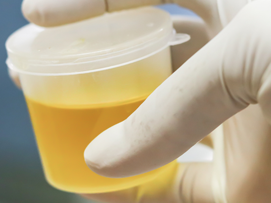urine sample