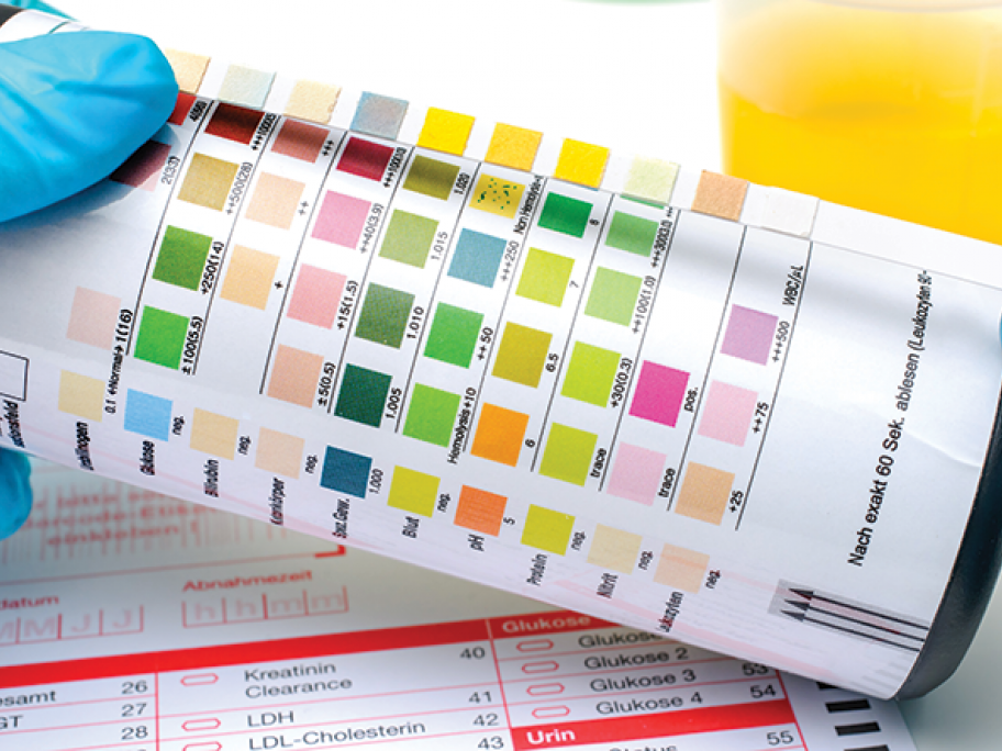 urine test