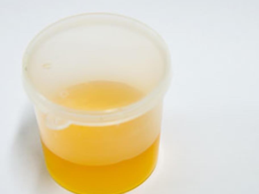Urine