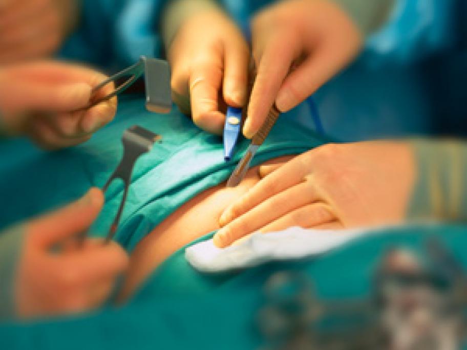 surgery