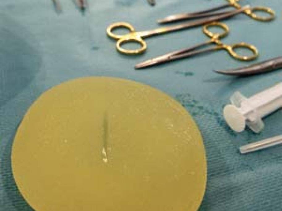 Breast implant