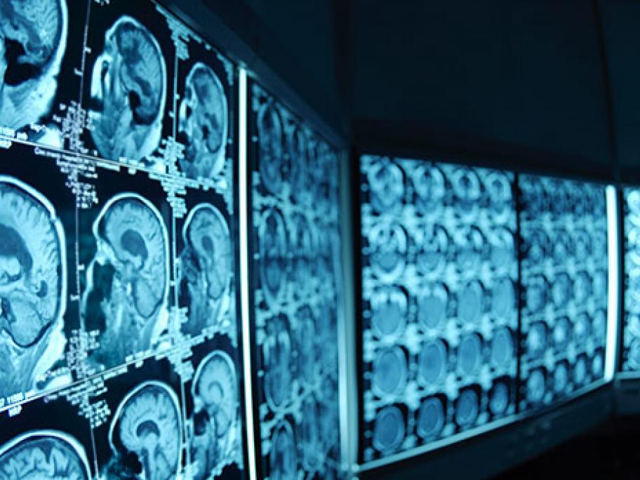 brain scans