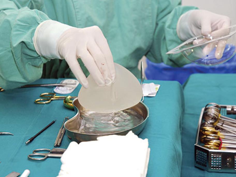 Breast implants