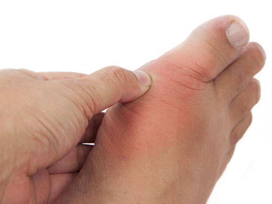 gout