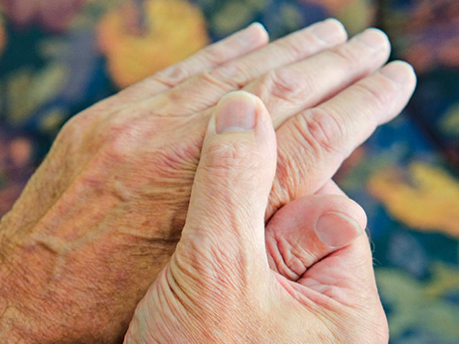 arthritis hands