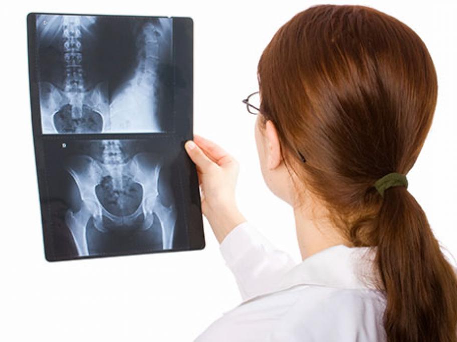 X-ray of pelvis