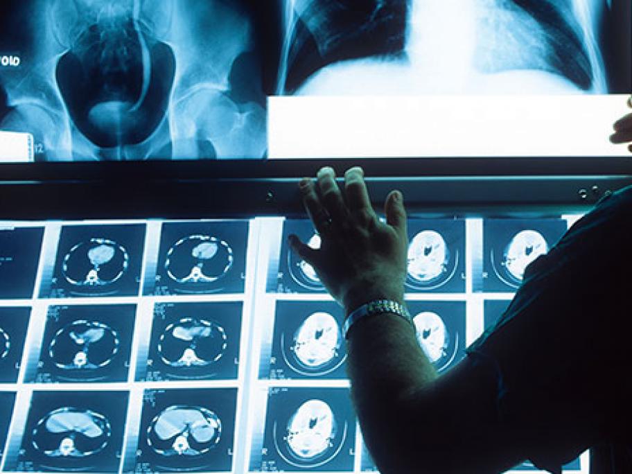 X-ray