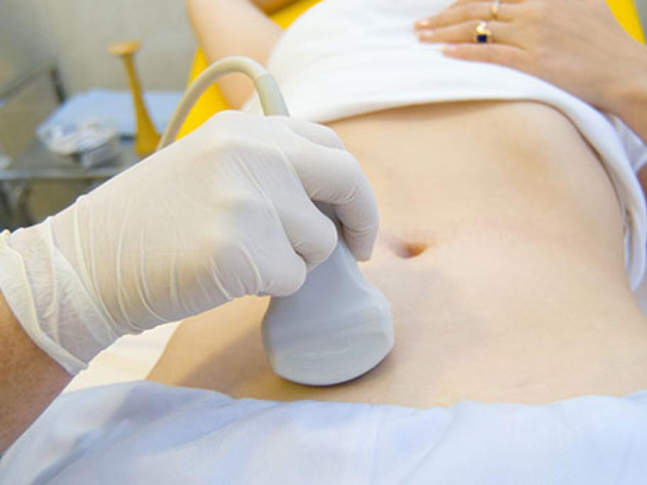 Ovarian cancer