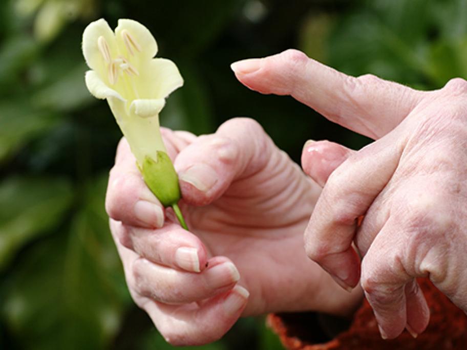rheumatoid arthritis