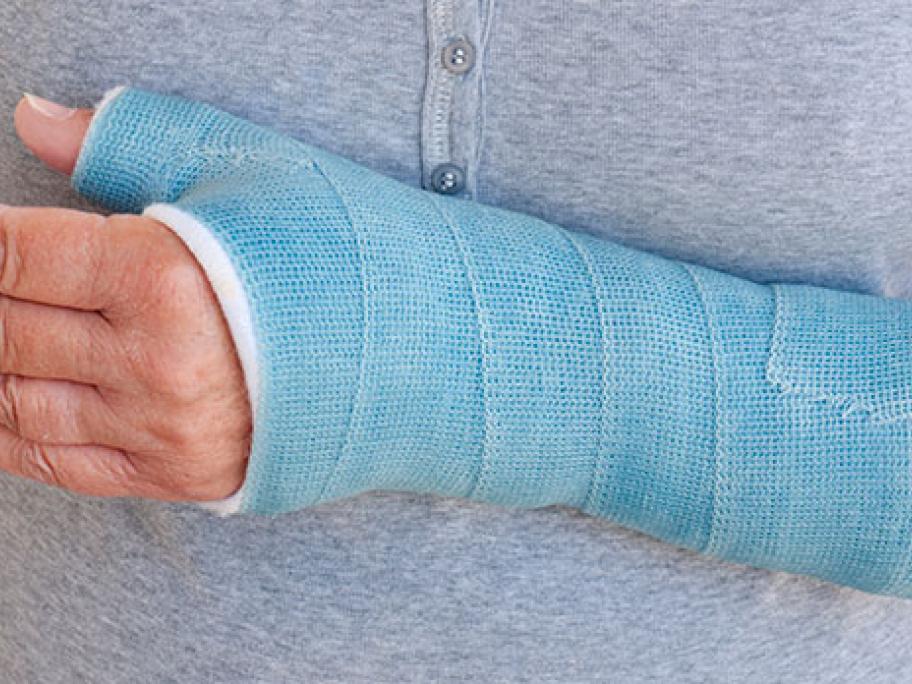 fracture and cast