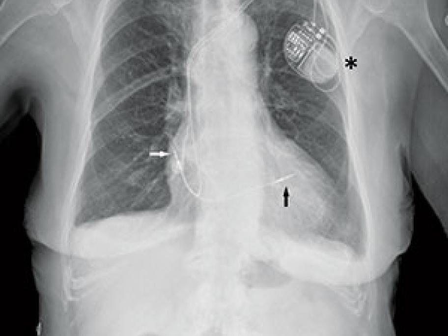 xray