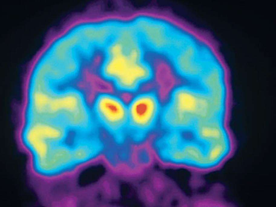 Brain scan