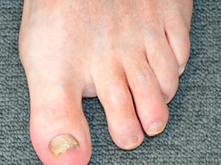 foot