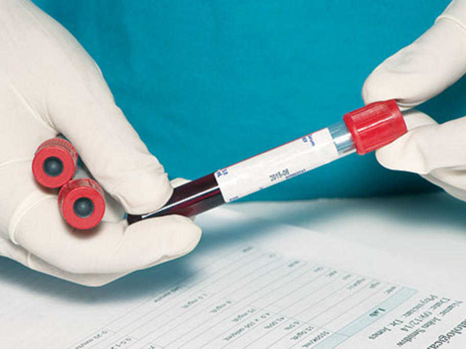 blood tests