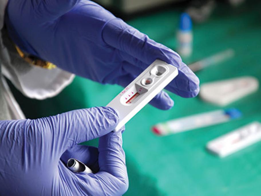 HIV testing
