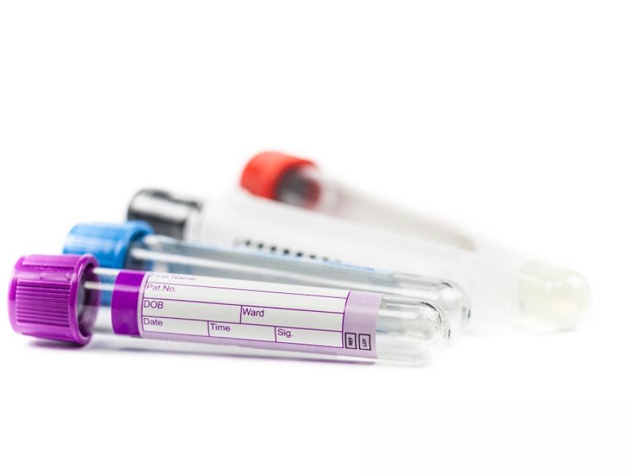 generic pathology tubes