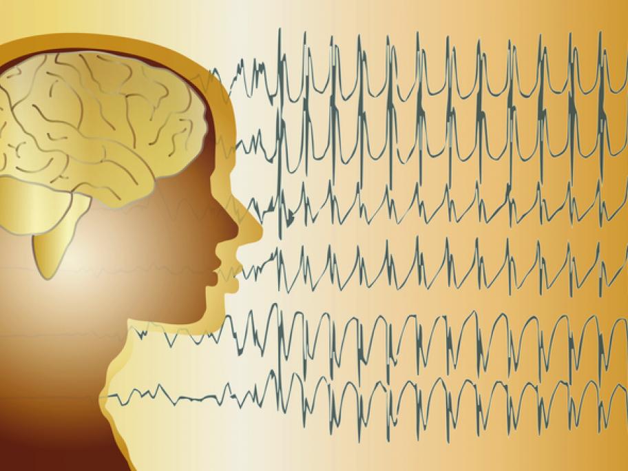 Epilepsy