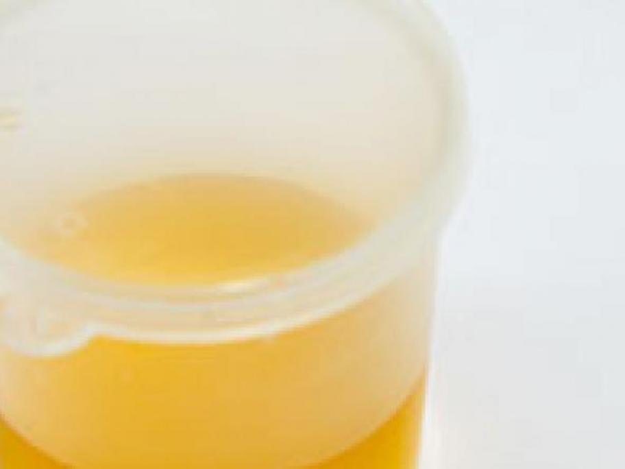Doctors flush urine therapy down the toilet