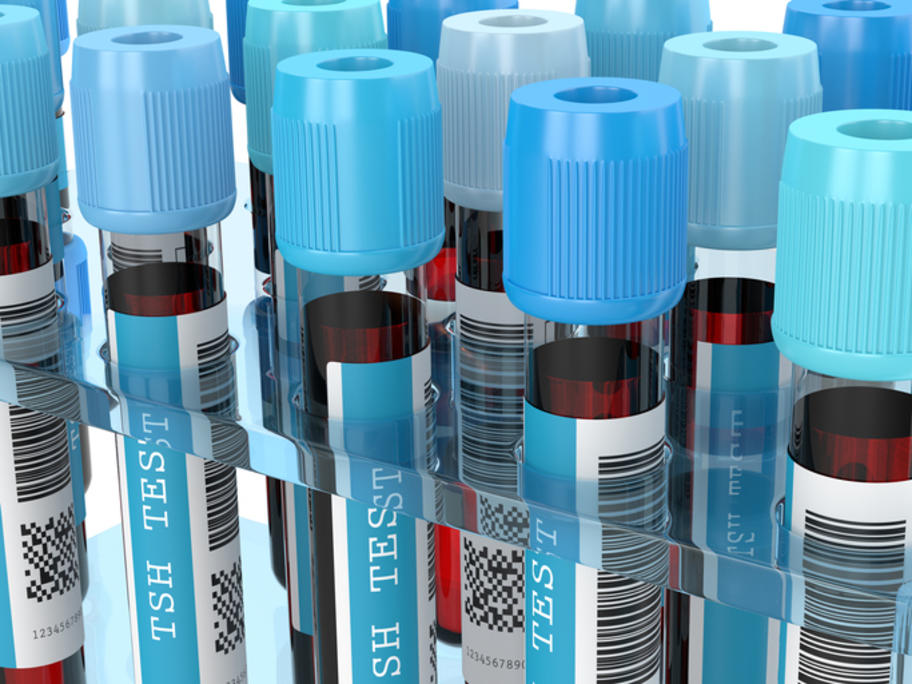 vials of blood awaiting TSH testing