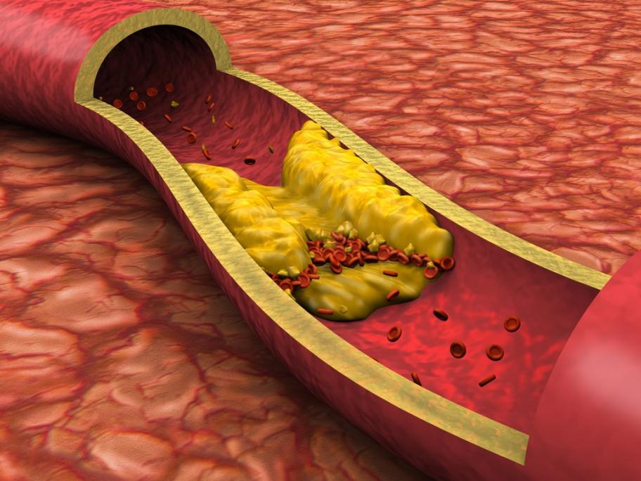 Cholesterol