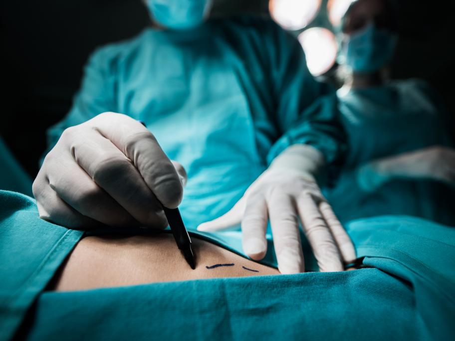 Surgery
