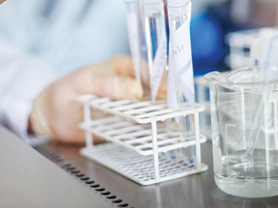 Stroke and heart disease research