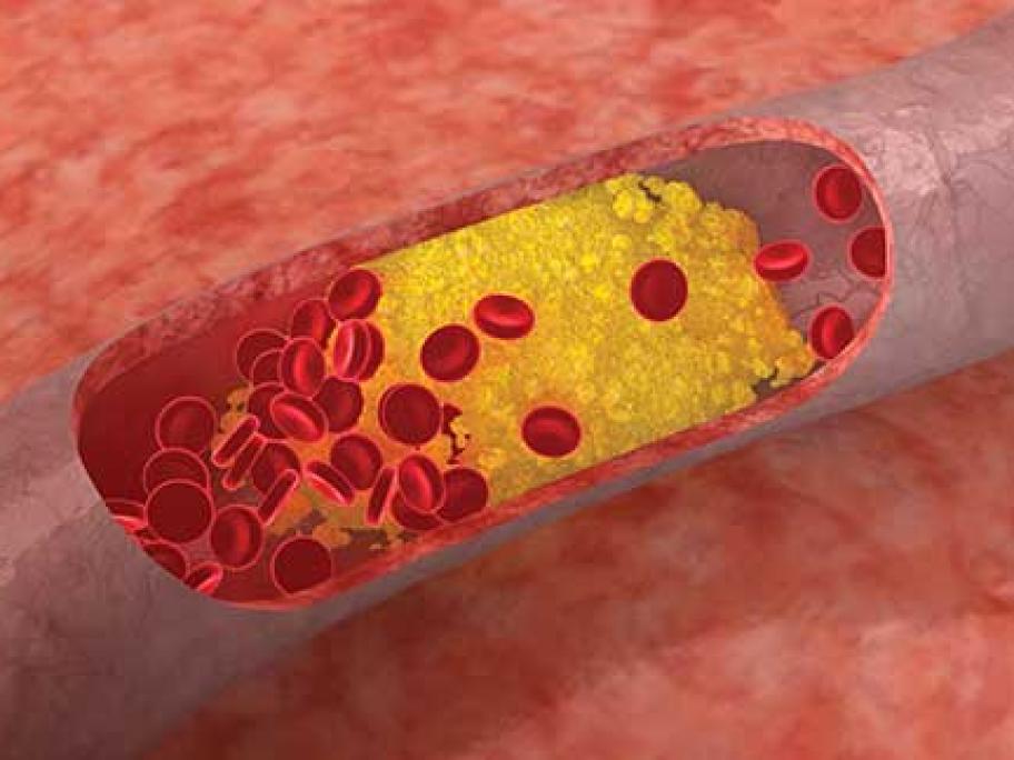 Cholesterol