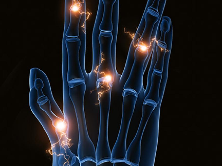 Hand