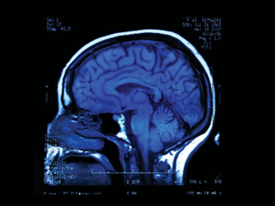 Procedures are used to identify the source of seizures in epilepsy