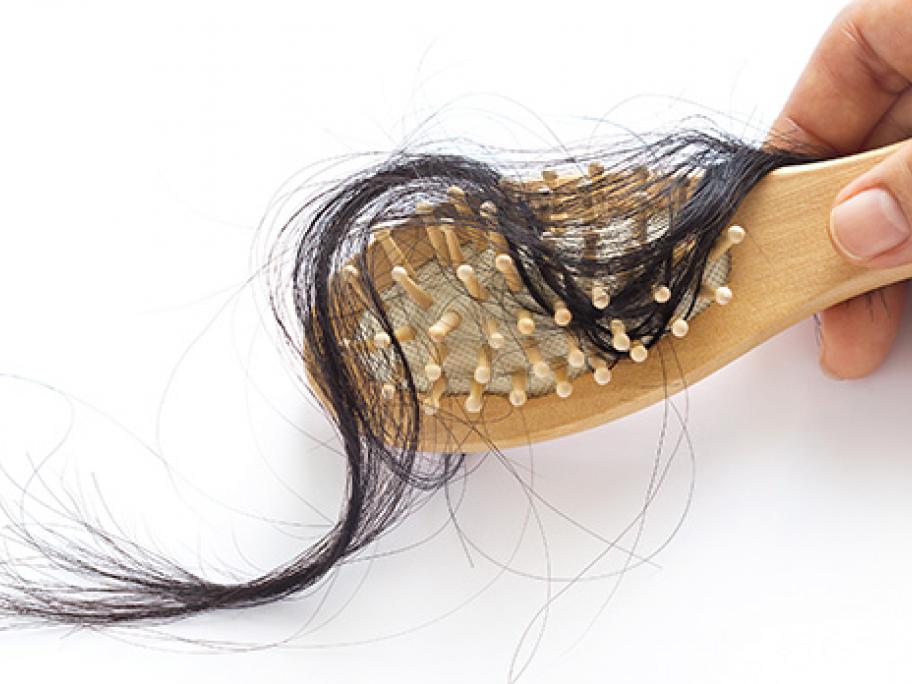 hair loss