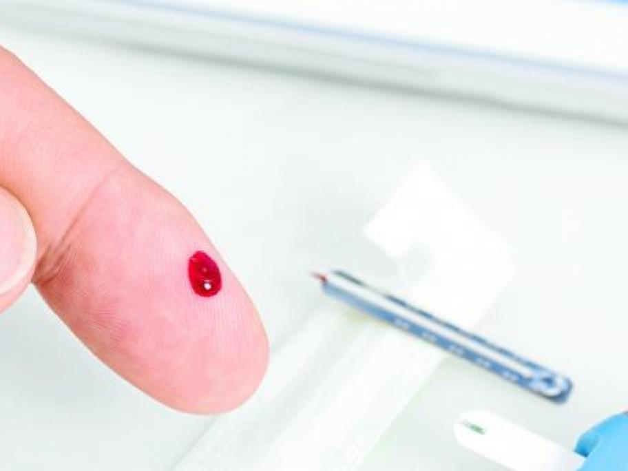 Finger prick glucose test