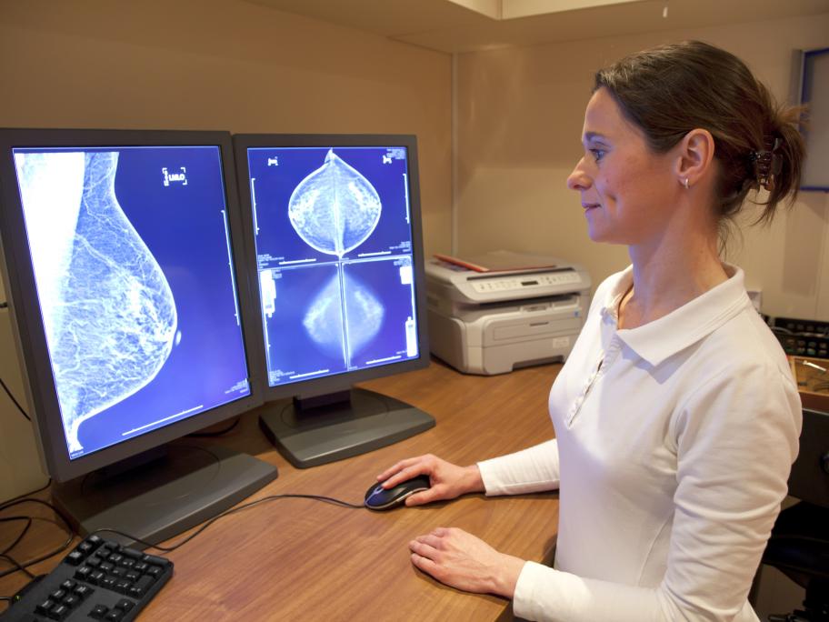 Mammogram